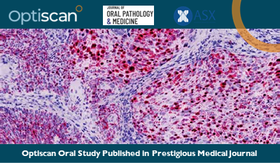 Optiscan ASX oral cancer web final